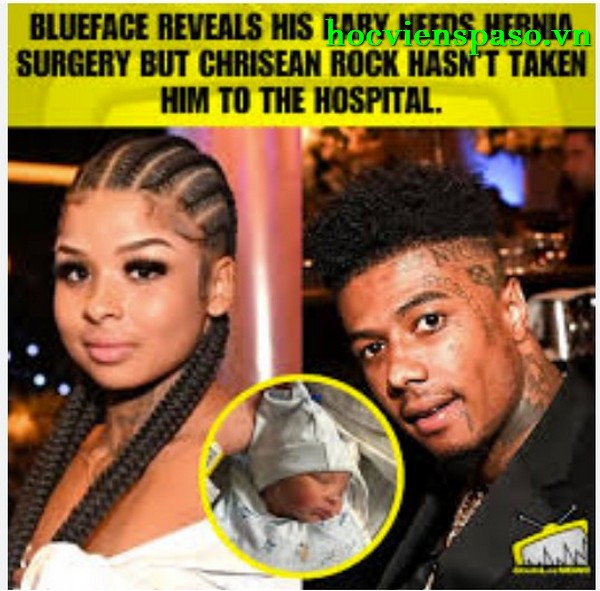 Blueface Baby Hernia Photo